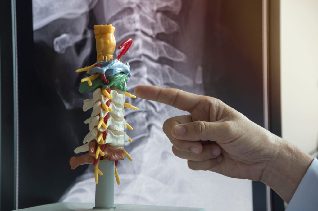 αυχενική δισκοκήλη χειρουργείο