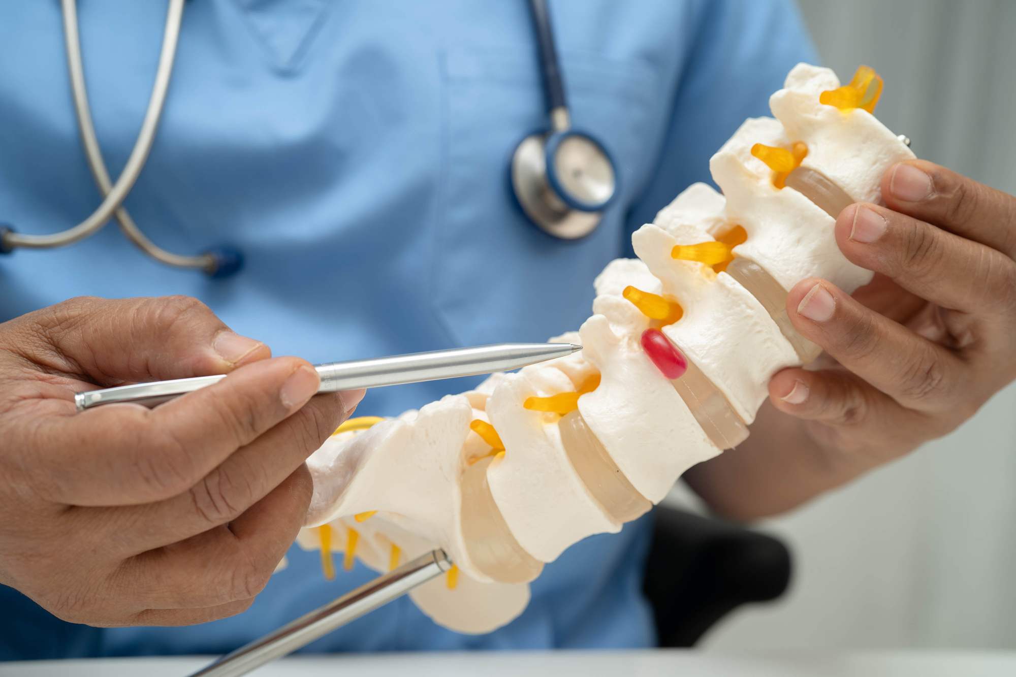 Σπονδυλική Στένωση: Θεραπεία και Επιλογές Χειρουργικής Αποκατάστασης